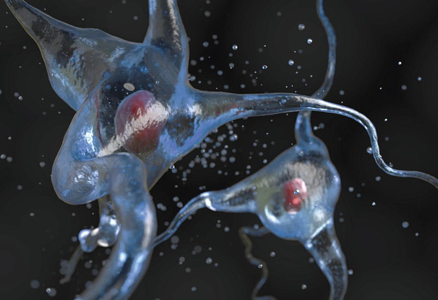 VUB-onderzoek legt link tussen eiwit en ziekte ALS