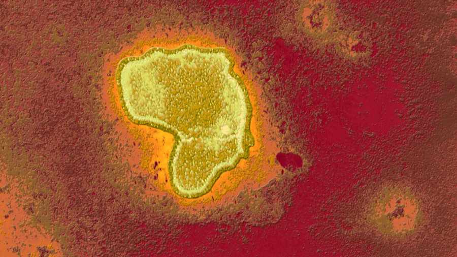 Vaccins tegen RSV kunnen bescherming bieden tegen astma