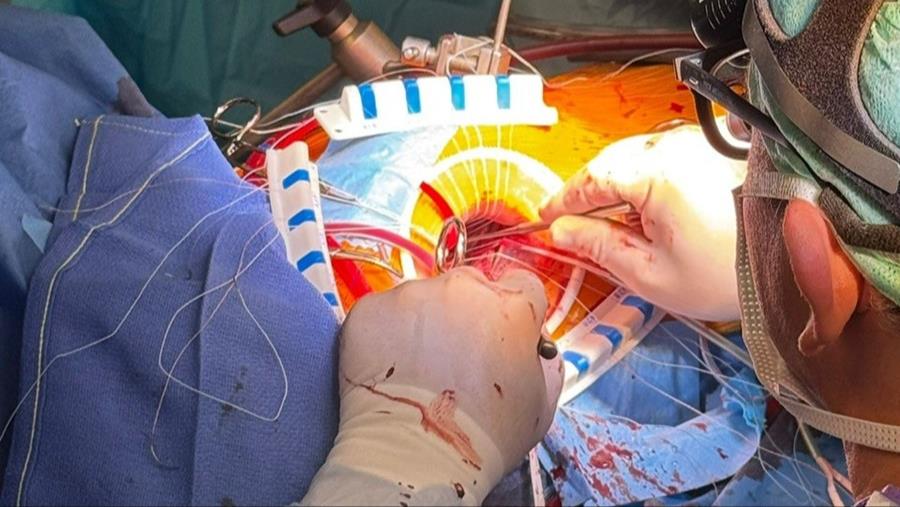 De transaxillaire procedure voor hartklepbehandeling